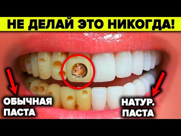 Зубы