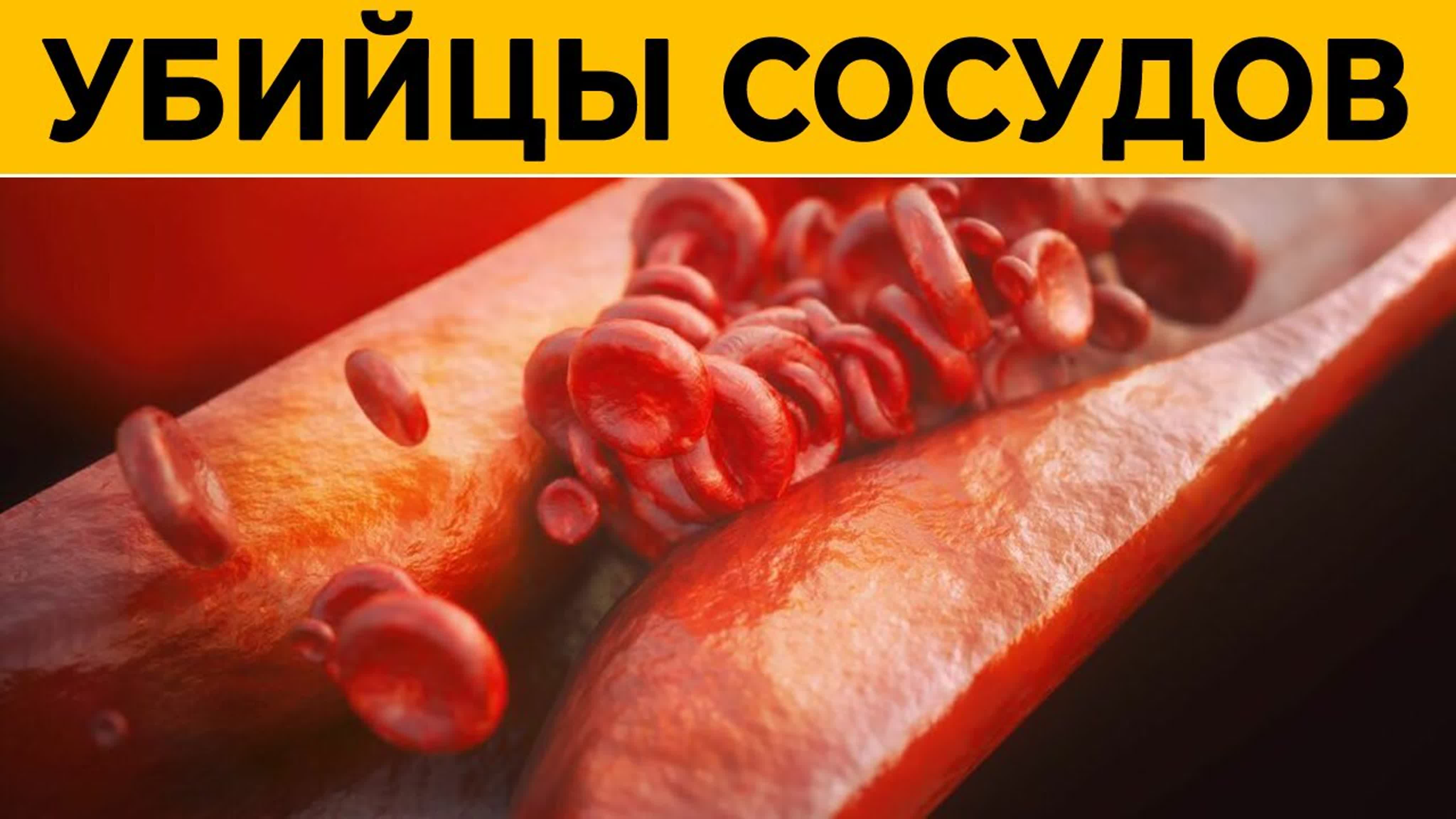 СУСТАВЫ, как новые! Лучшие упражнения!