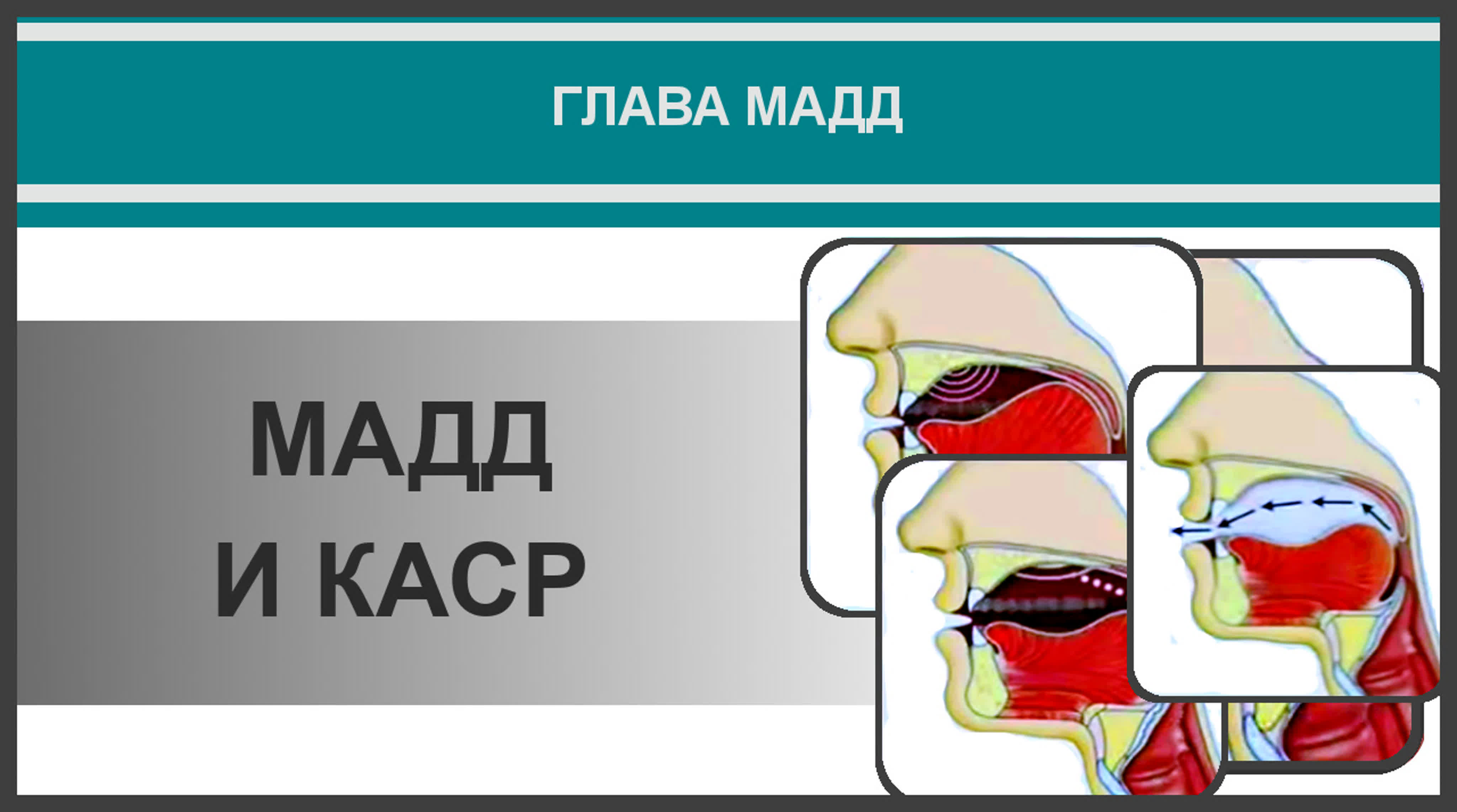 11. Айман Сувейд. Мадд
