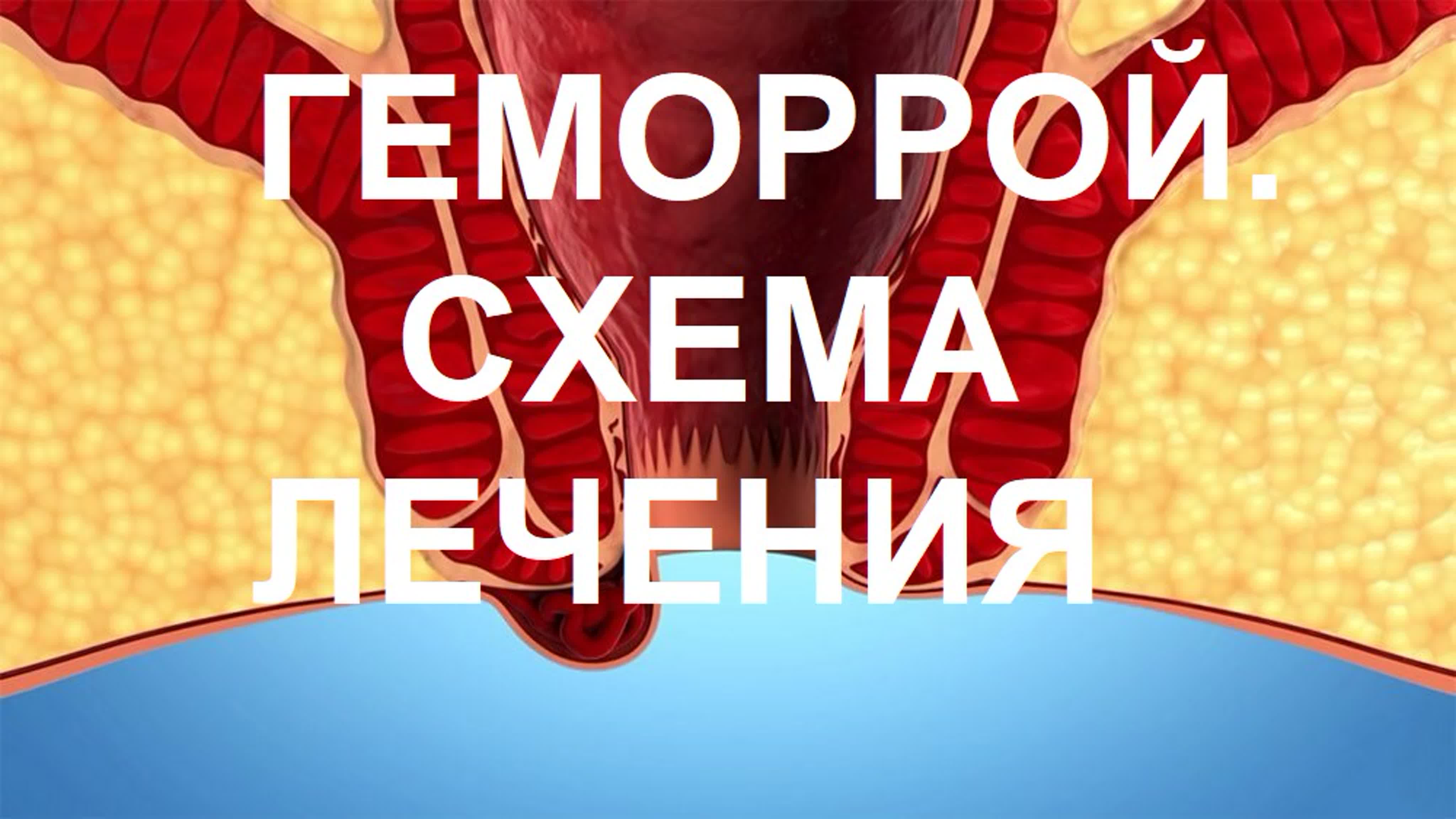 Универсальные схемы