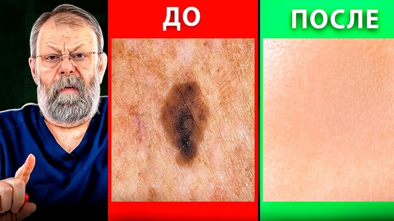 ЗДОРОВЬЕ : Кожа, волосы