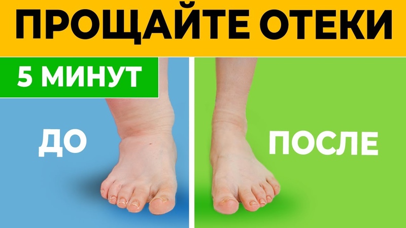 ЗДОРОВЬЕ: О т ё к и