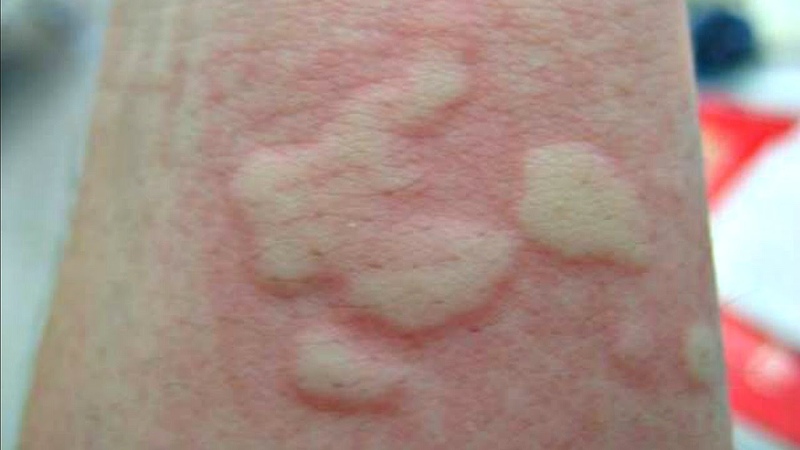 голубая акула. конец 2