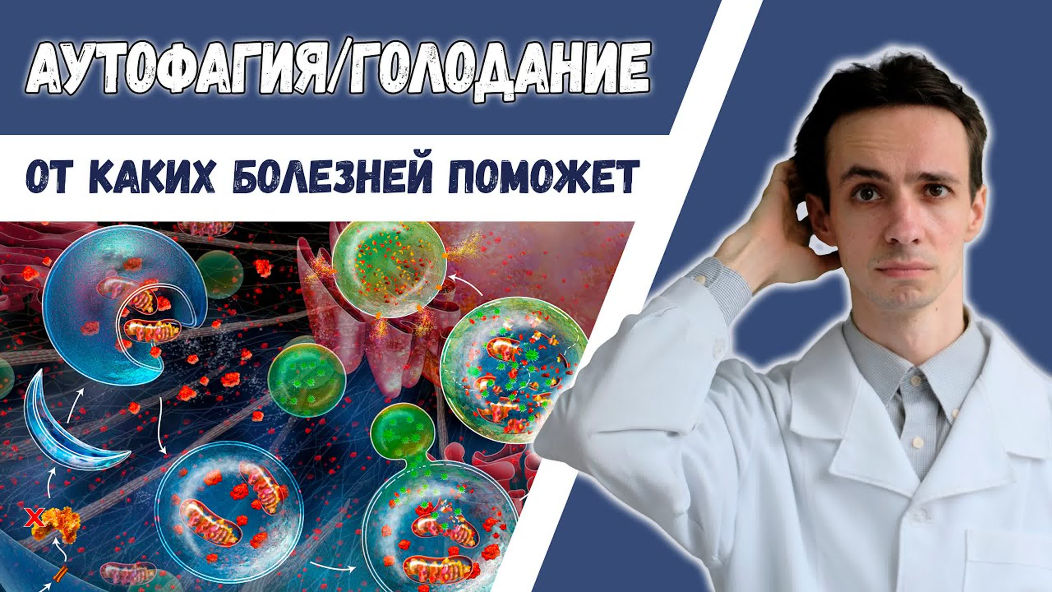 Аутоиммунные заболевания
