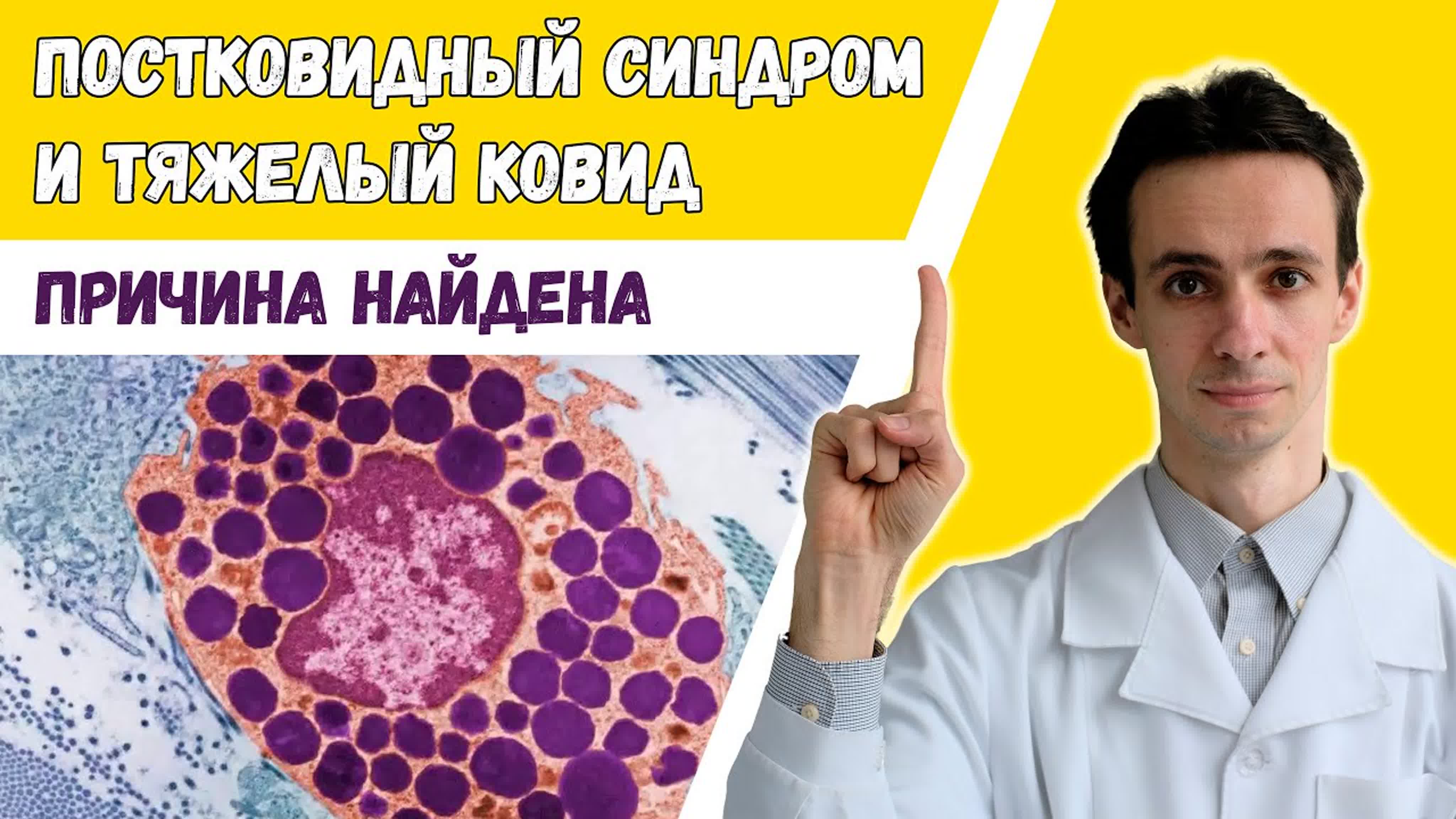 Постковидный синдром