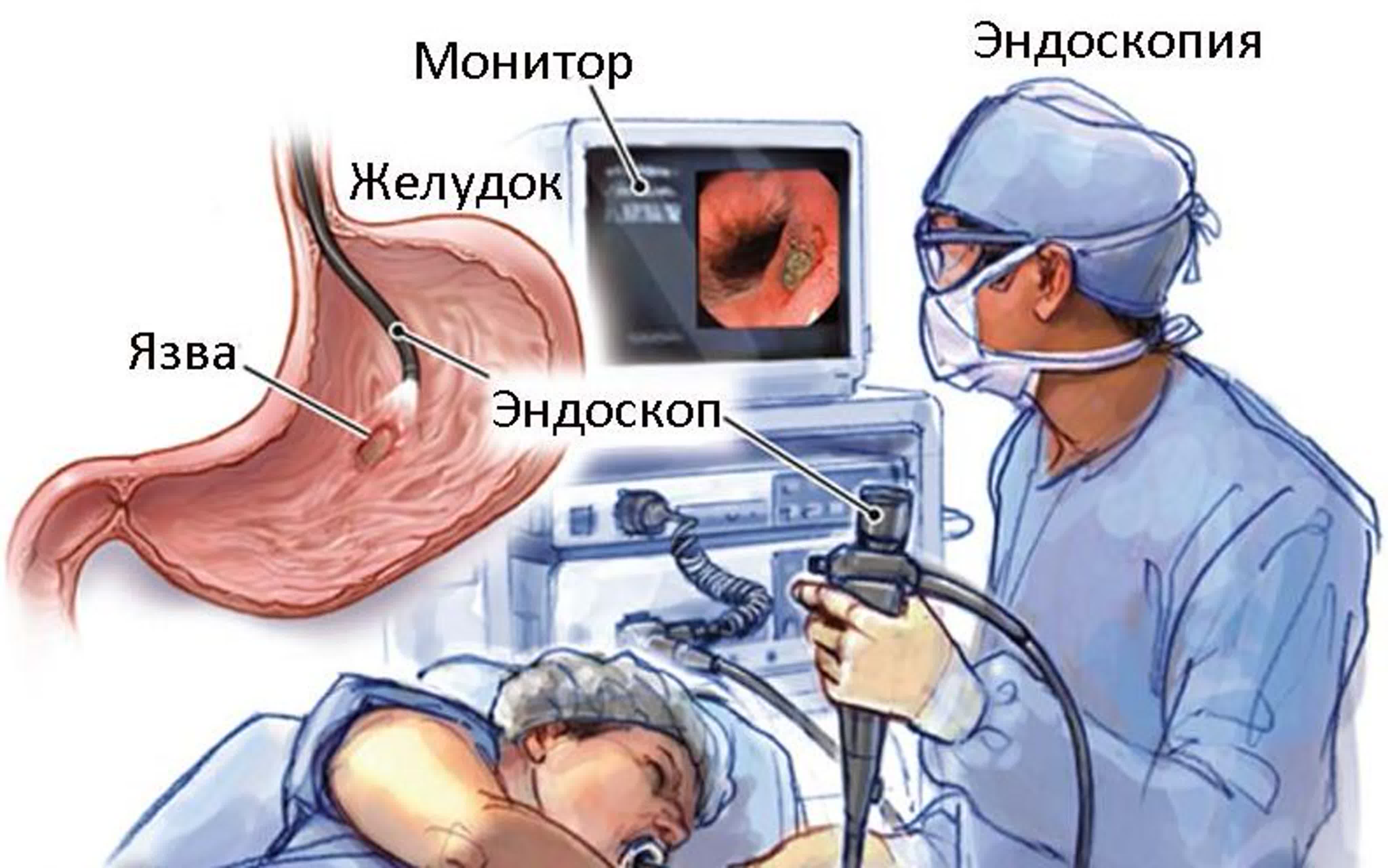 Эндоскопия