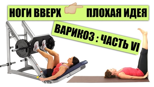 Варикозное расширение вен