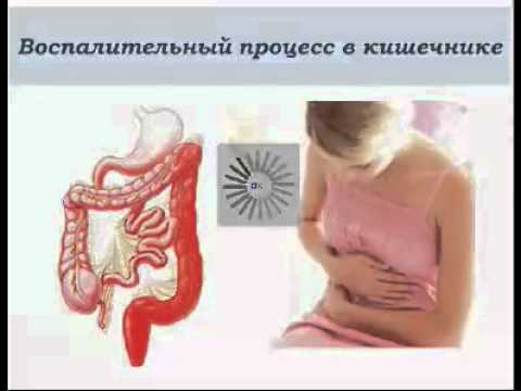 аллергия