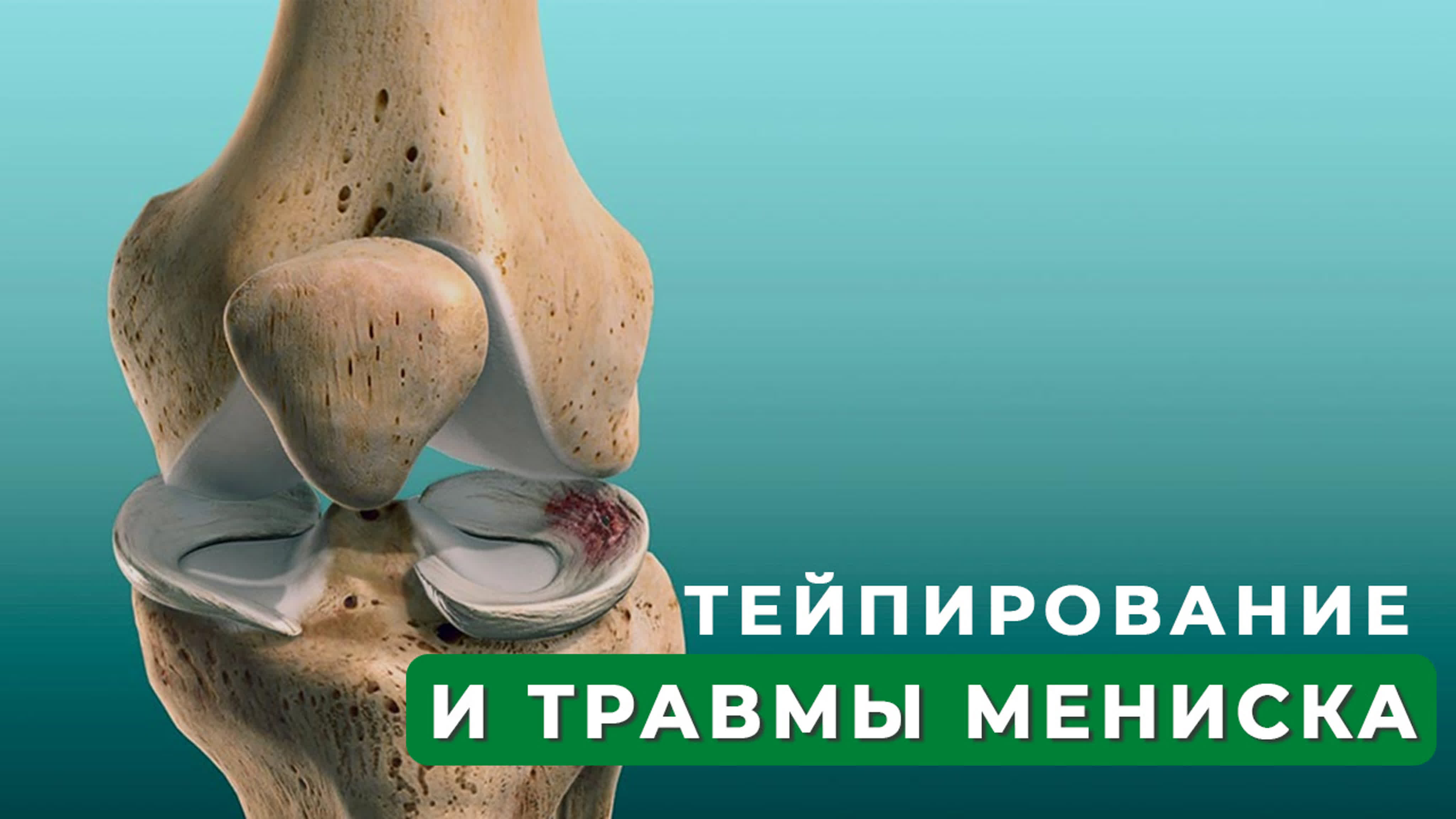 тейпы