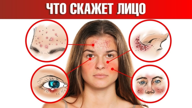 ЗДРАВА