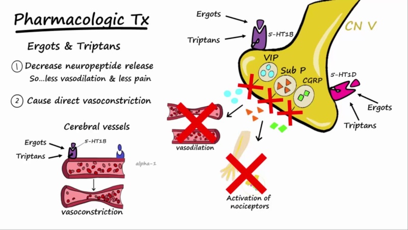 Neurology