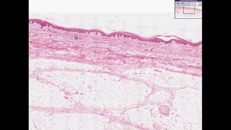 Shotgun Histology