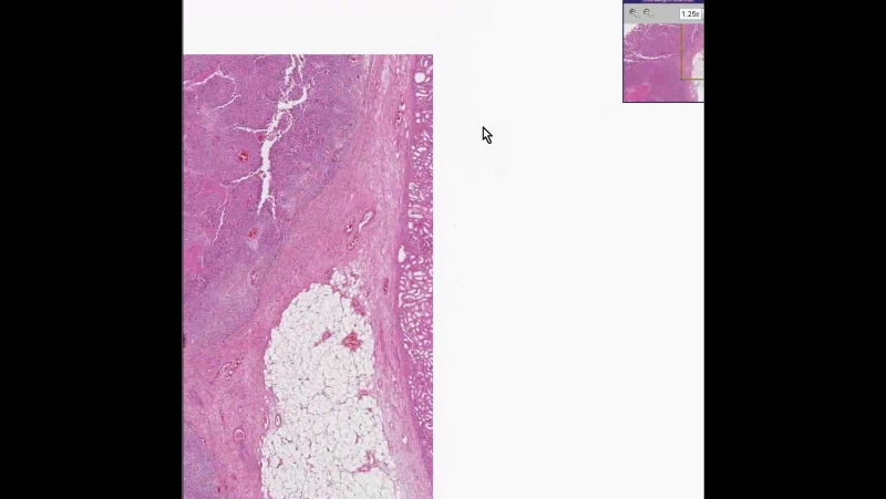 Histopathology