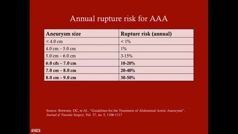 Paul Bolin - Crash! USMLE Step 2 & 3 - [Surgery] - Vascular Surgery