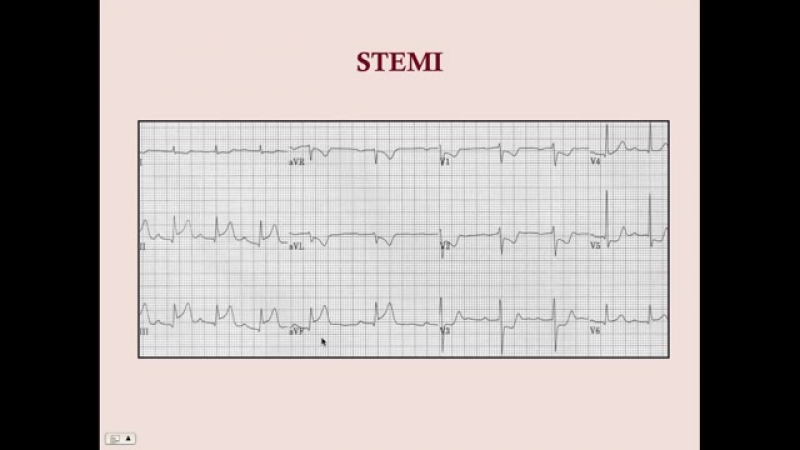 Paul Bolin - Crash! USMLE Step 2 & 3 - [Medicine] - Cardiology