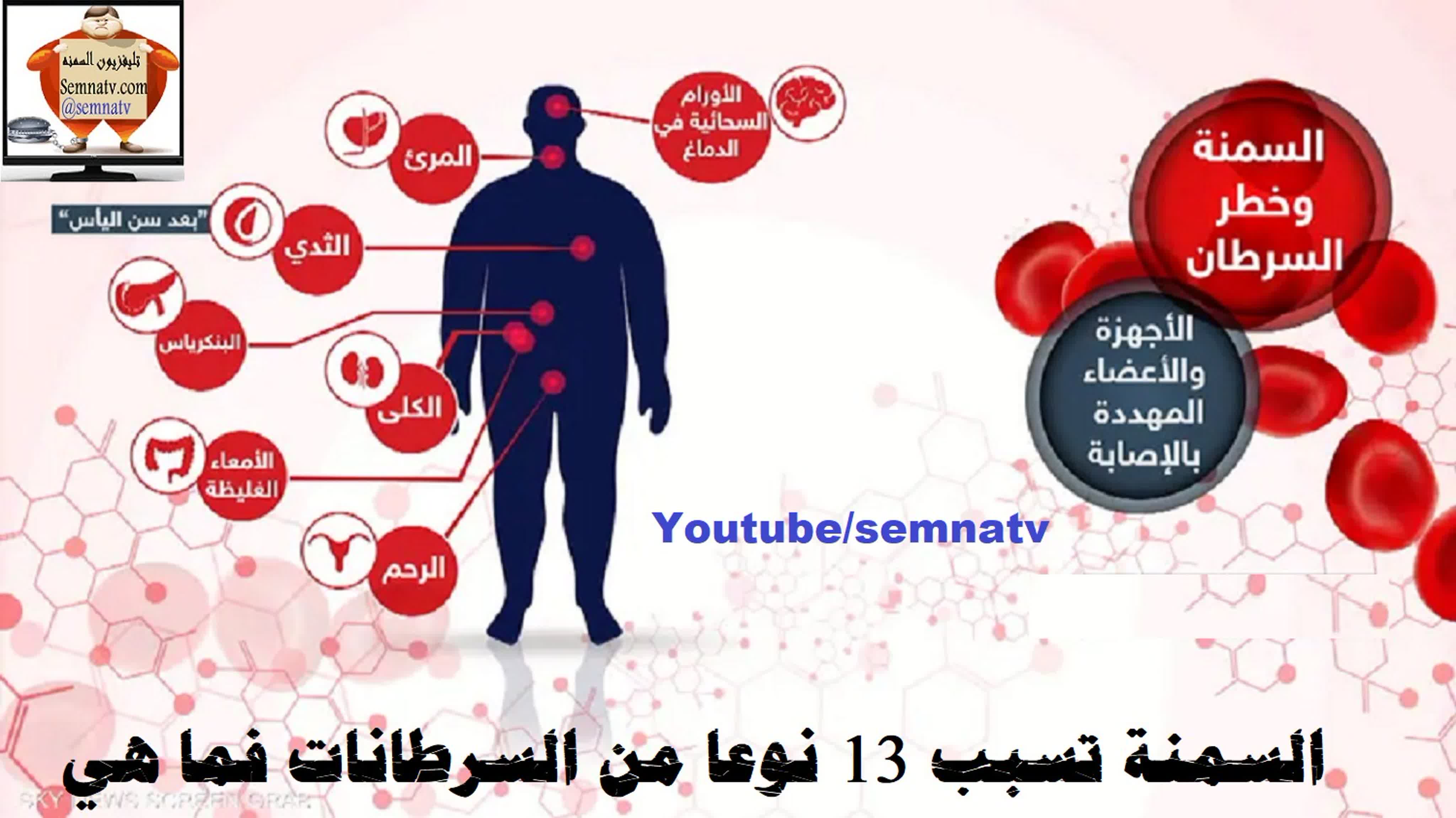 السمنه والسرطانات