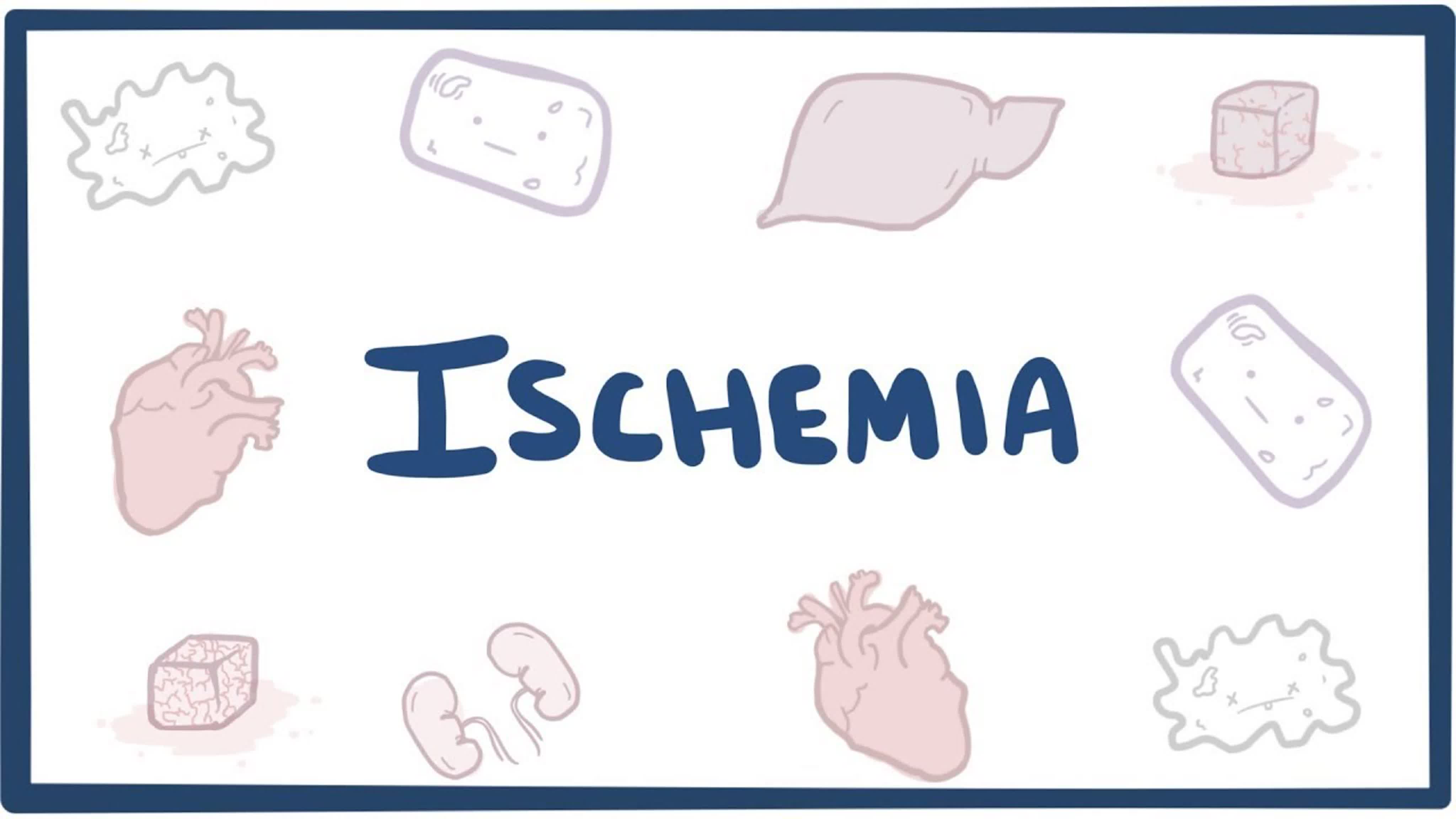 Peripheral circulatory disorders