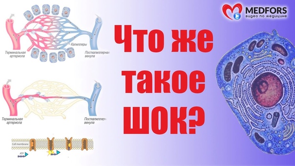Экстремальные состояния