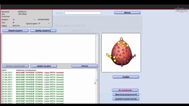 РЕЗУЛЬТАТЫ ПРОСЛУШИВАНИЯ ПРОГРАММ МЭЦ