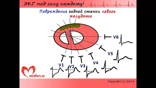Видеокурс "ЭКГ под силу каждому".